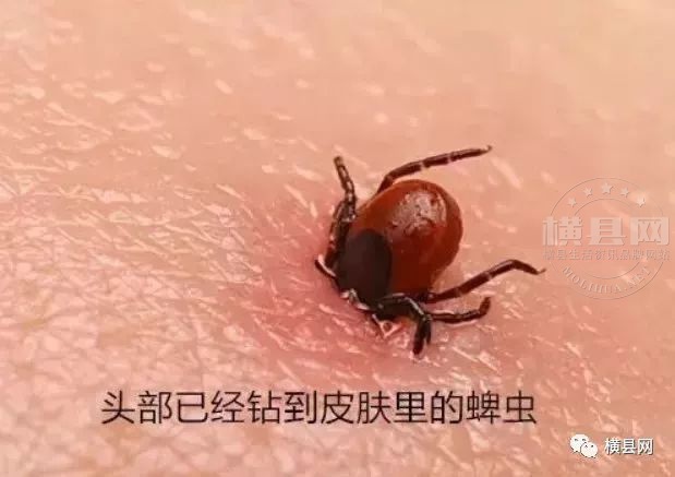 茉莉花论坛 69 交流互动 69 横县茶坊 69 帖子  蜱虫俗称草爬子